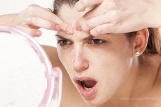 How To Treat The Different Types of Acne : 4 Different Ways To Treat Them Fast
