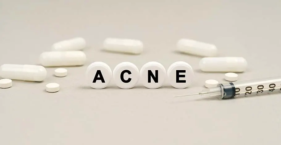 tratamentos para acne