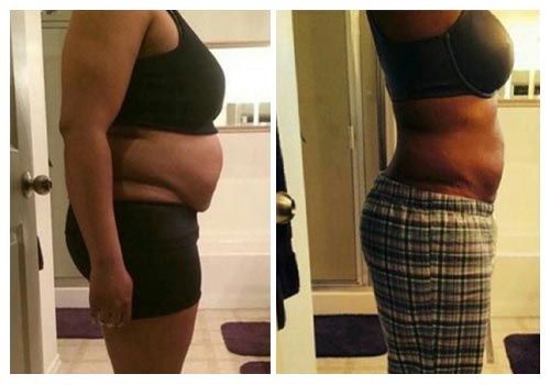Iaso Tea Before and after result