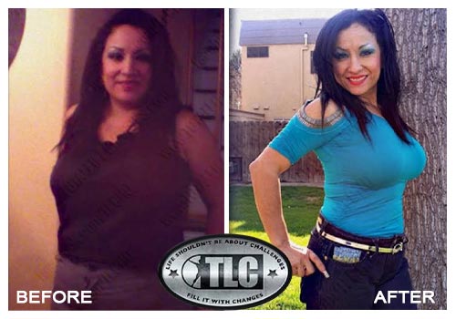 Iaso Tea Before and after result