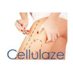 Cellulaze Reviews: Does It Really Work As Advertised?