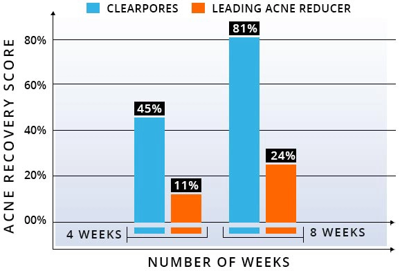 Graphique de traitement de l’acné des pores clairs