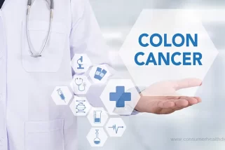 Colon Cancer: Causes, Symptoms, and Treatment