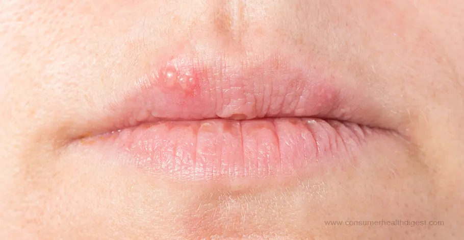 common causes of itchy burning lips