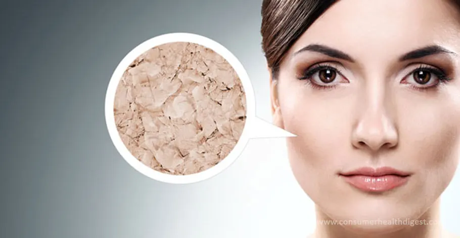 Dehydrated Skin Wrinkles: How Dehydration Affects Your Face?