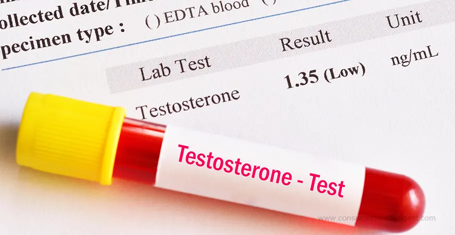 Diagnosing Low Testosterone