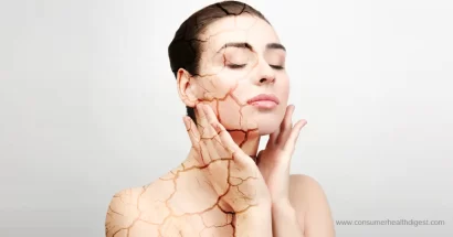 Compreendendo a pele seca: causas, sintomas e remédios