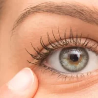 eyelash growth abnormalities