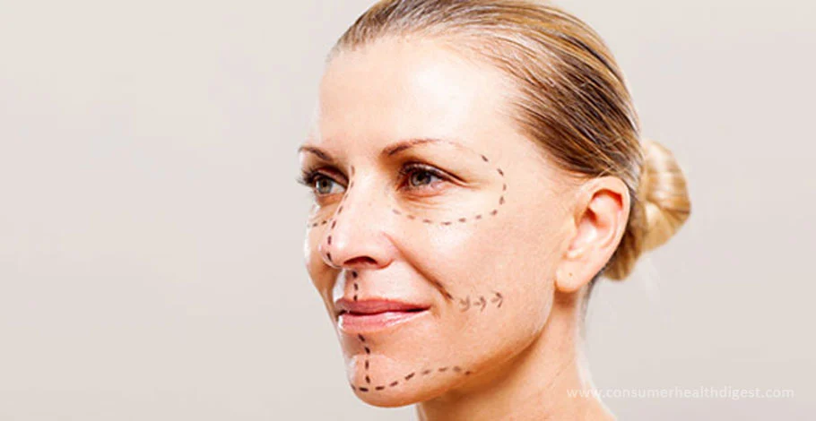 Face Lift - What to Expect from this Surgery?