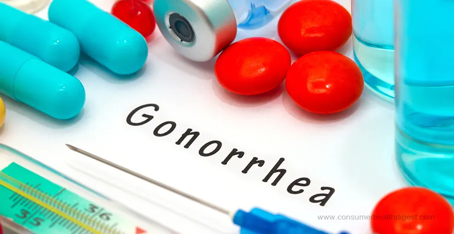 Gonorrhea Symptoms, Causes, Treatment: Growing Sexually Transmitted Disease