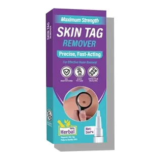 inscape data skin tag remover