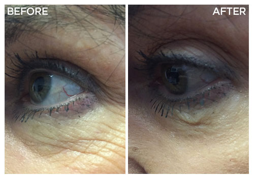 Jeunesse Instantly Ageless Before and After Pictures
