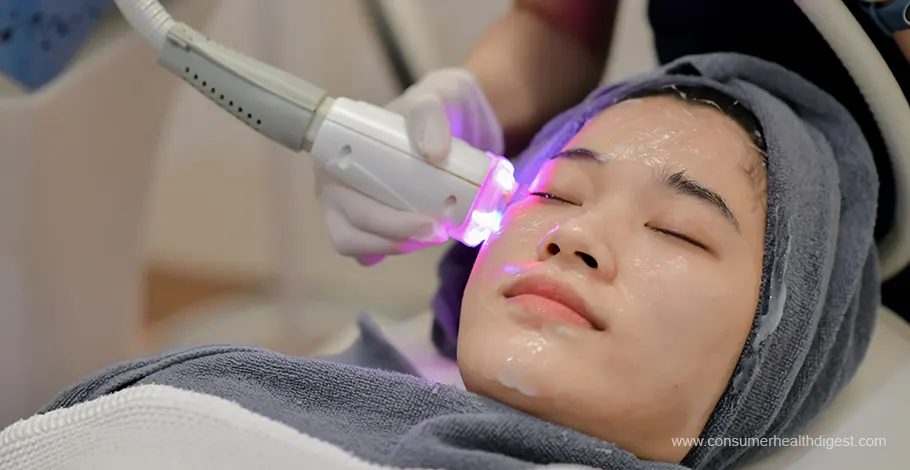 laser therapy for face