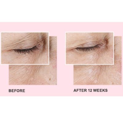 Mary Kay TimeWise Before and After
