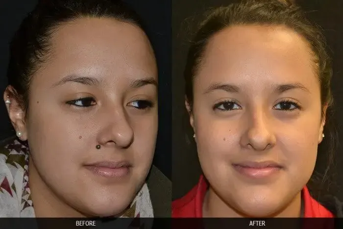 Skincell Pro Before and After Pictures