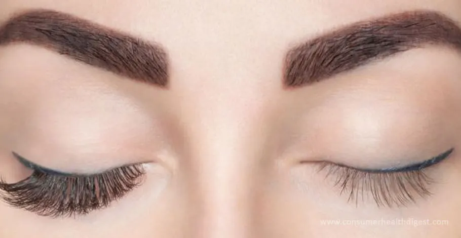 Suffering From Eyelash Weakness? Learn How You Can Get Rid Of It!