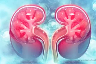 Understanding Water Retention in Kidney Patients: Causes and Management
