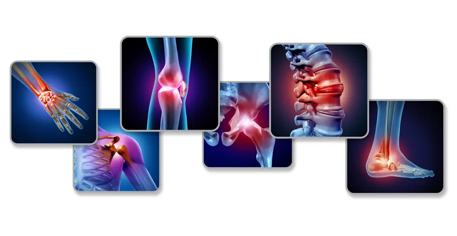 Discover Common Joint Pain Causes: Easy-to-Read Guide for Everyone