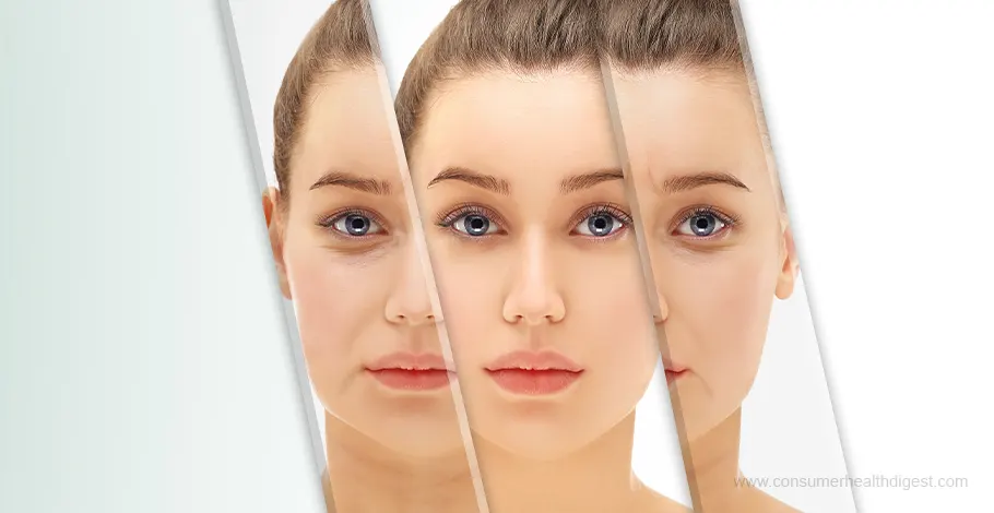 Wrinkles and Fine Lines: Causes and Preventions You Should Know